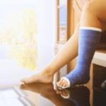 broken leg in a plaster cast with soft-focus in the background