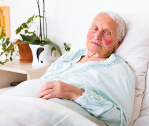 Nursing-Home-Patient-Pressure-Sores